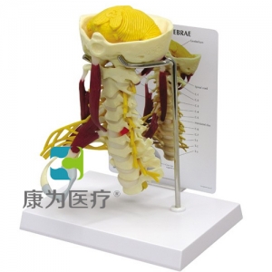 “康為醫(yī)療”醫(yī)患關(guān)系溝通模型-頸椎帶神經(jīng)、肌肉附小腦模型 （醫(yī)學(xué)指導(dǎo)模型）