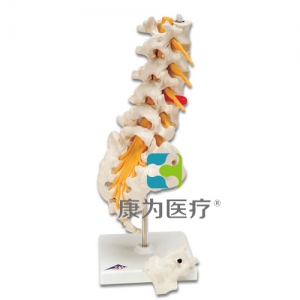 腰脊柱，有脊外側(cè)椎間盤脫出
