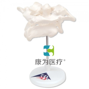 環(huán)椎和樞椎組合，置于可拆卸基架