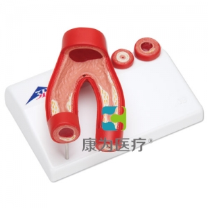 動(dòng)脈硬化模型，帶動(dòng)脈切面，2部分