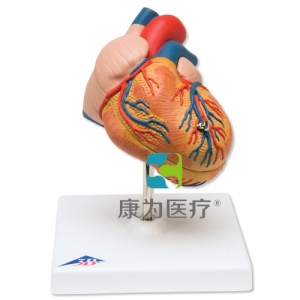 經(jīng)典心臟模型，呈左心室肥大，2部分