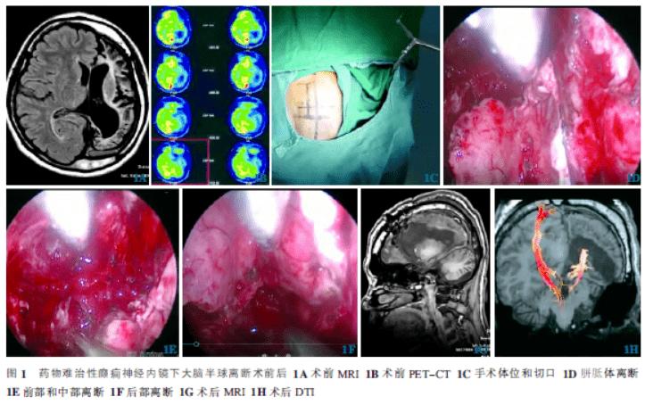 VST型神經(jīng)內(nèi)鏡手術(shù)模擬訓(xùn)練系統(tǒng) VST型神經(jīng)內(nèi)鏡手術(shù)模擬訓(xùn)練系統(tǒng)